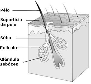 Acne - Unidade pilo-sebácea