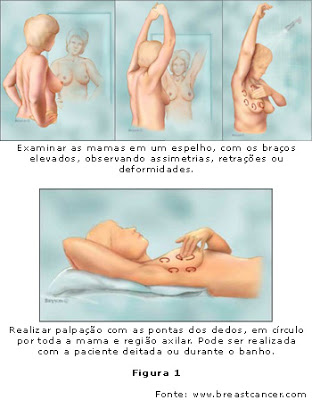 Autoexame para câncer de mama