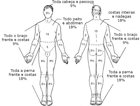 Extensão da queimadura no corpo