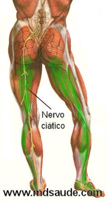 Dor no nervo ciático