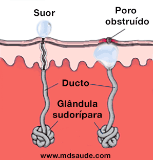 Como surge a brotoeja