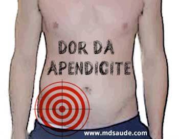 Localização típica da dor da apendicite