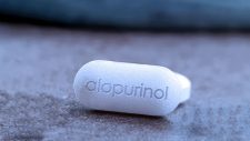 Alopurinol