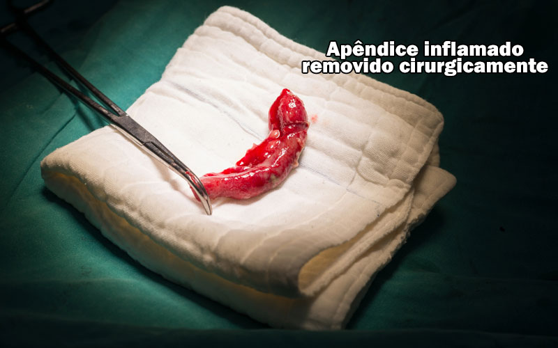 Foto real do apêndice