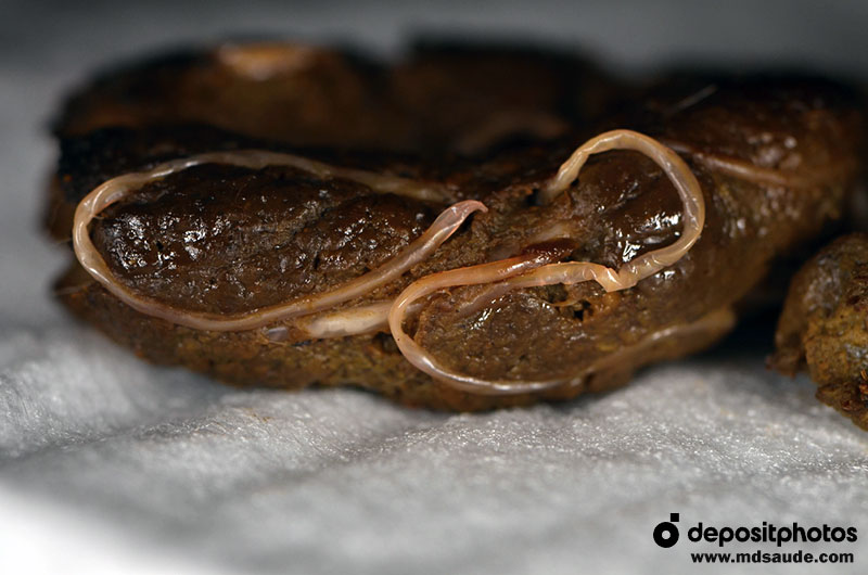 Vermes nas fezes (Ascaris lumbricoides)
