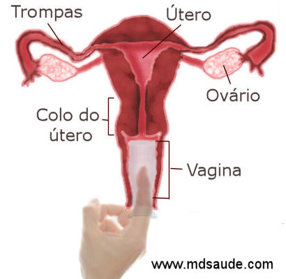 Preservativo feminino
