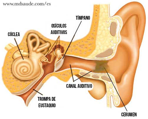 Acumulación de cera en los oídos