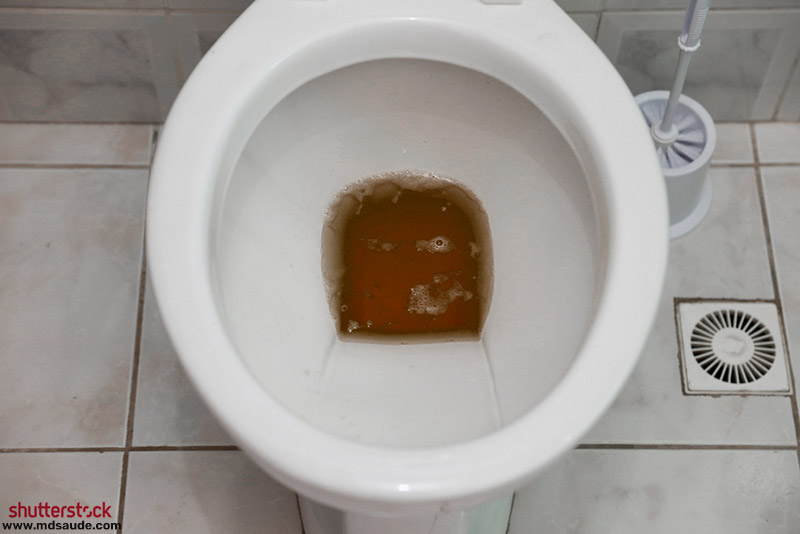 Colúria