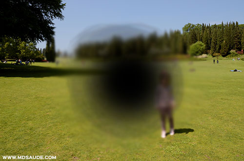 degeneração macular - perda da visão central