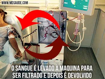 Hemodiálise