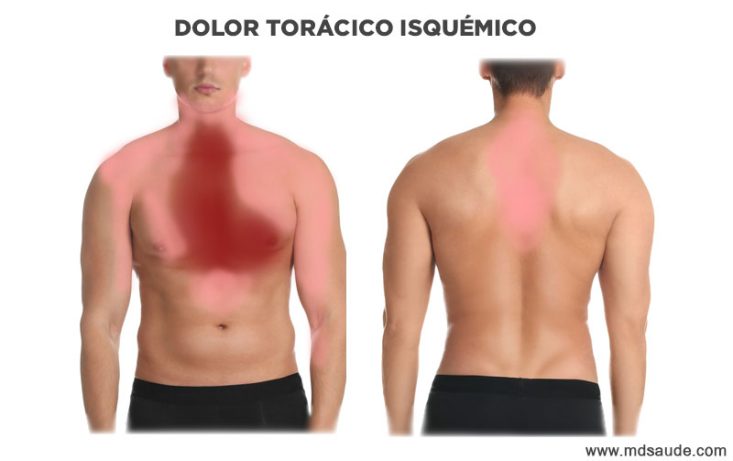Dolor de la isquemia cardíaca