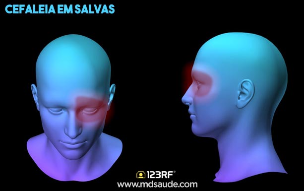 características da cefaleia em salvas