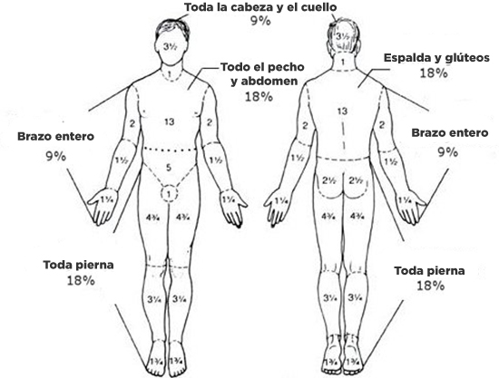 Extensión de la quemadura