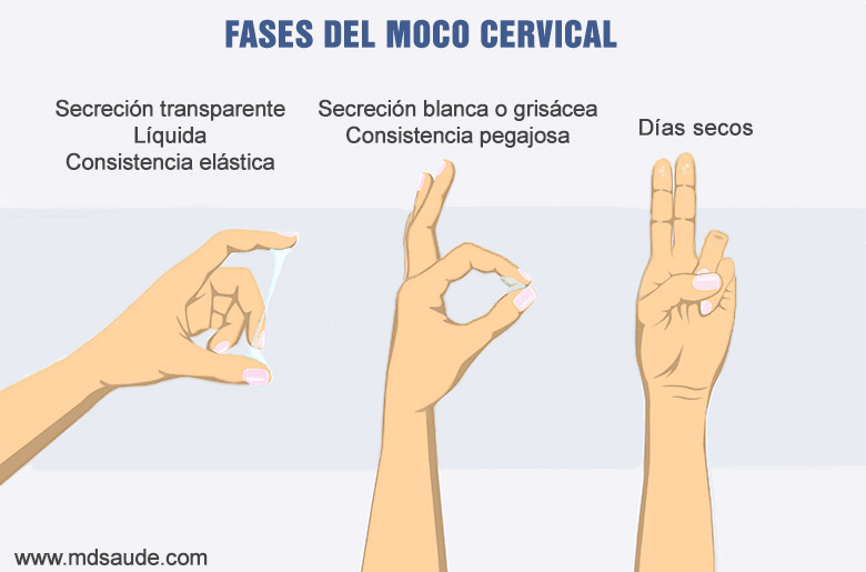 Moco cervical