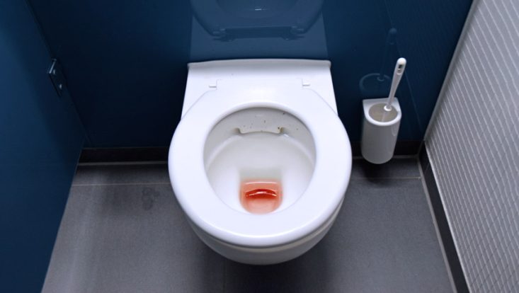 Hematúria: vaso sanitário com sinais de sangue após a micção.