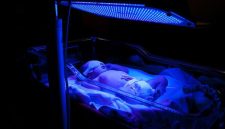 Icterícia neonatal