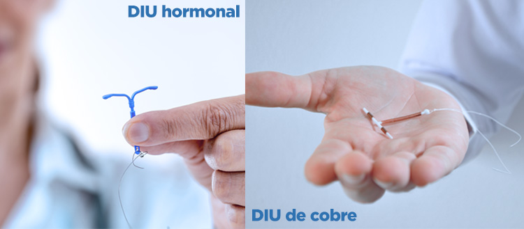 SIU y DIU