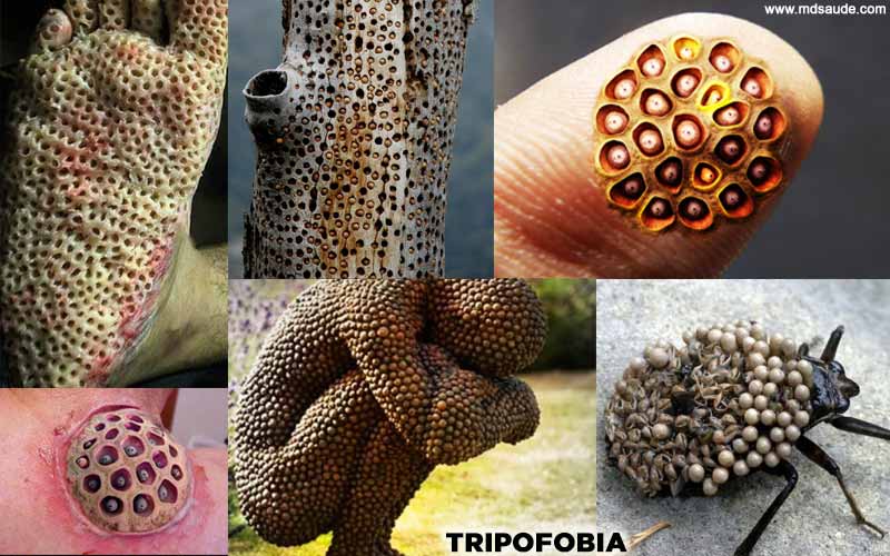 Imagens tripofobia