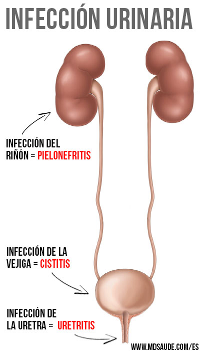 Sistema urinario