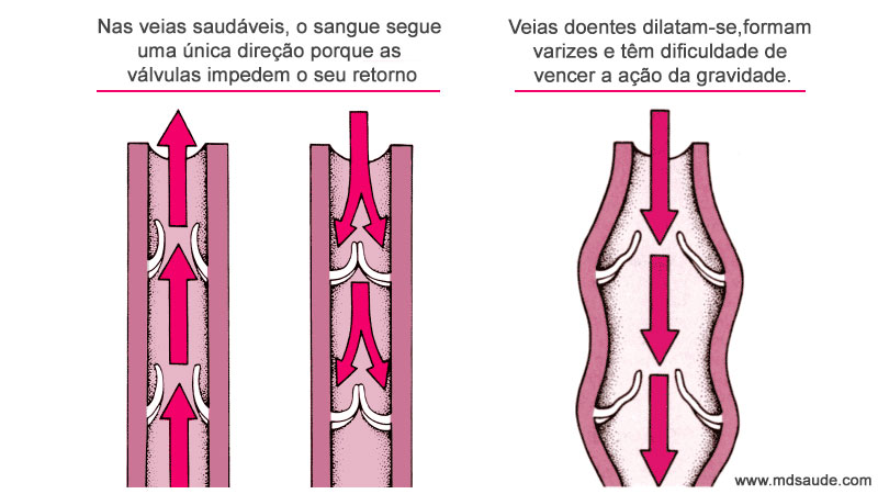 Sistema de válvulas das veias