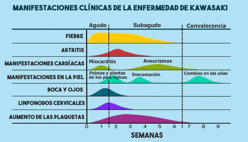 Síntomas de la enfermedad de Kawasaki