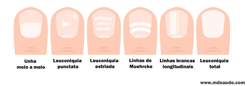 Leuconiquia