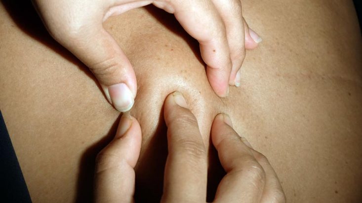 Consistência elástica do lipoma