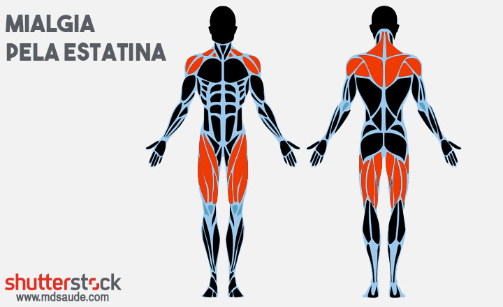 Dor muscular provocada pelas estatinas