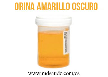 Orina amarillo oscuro