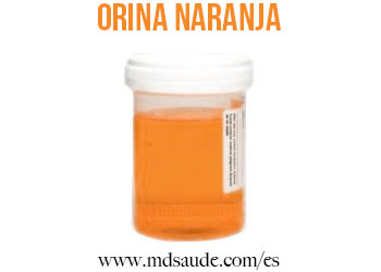 Orina naranja