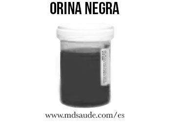Orina negra