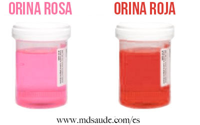 Orina roja o rosa