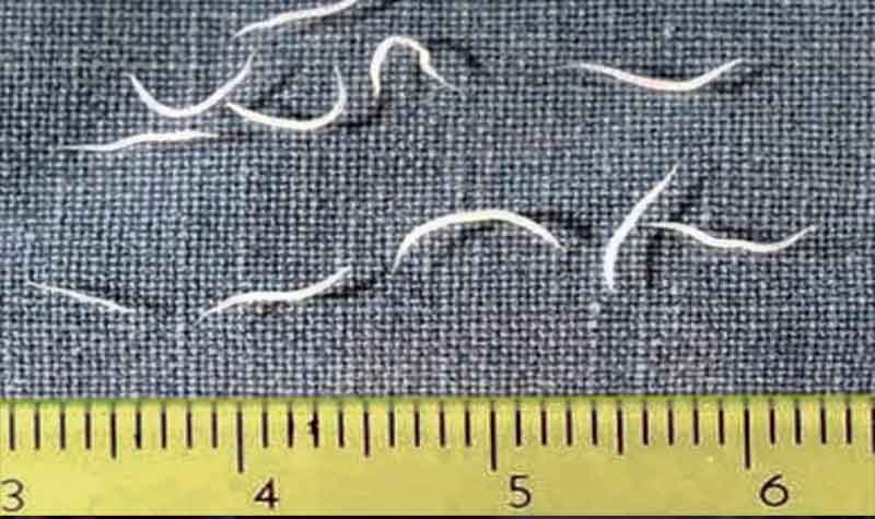 Oxiuro