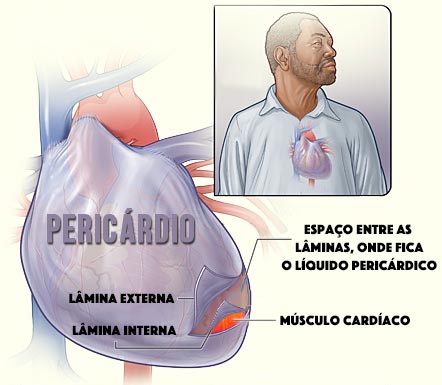 pericárdio - pericardite