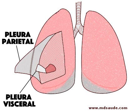 Pleuras