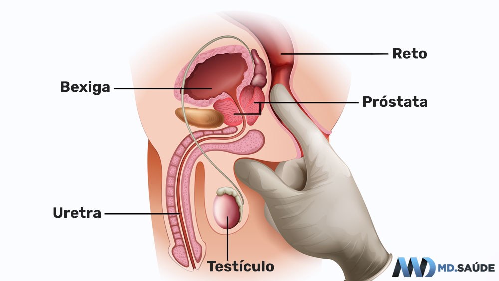 Localização da próstata