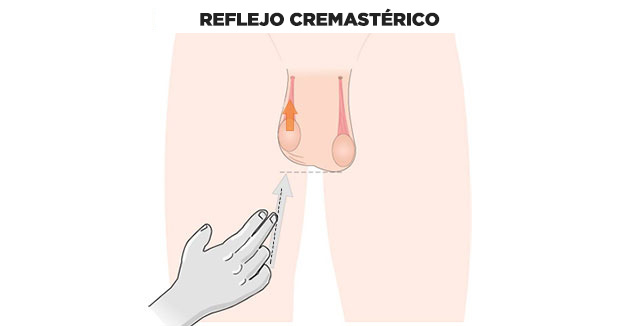 reflejo cremastérico