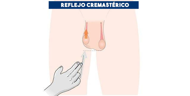 Reflejo cremastérico
