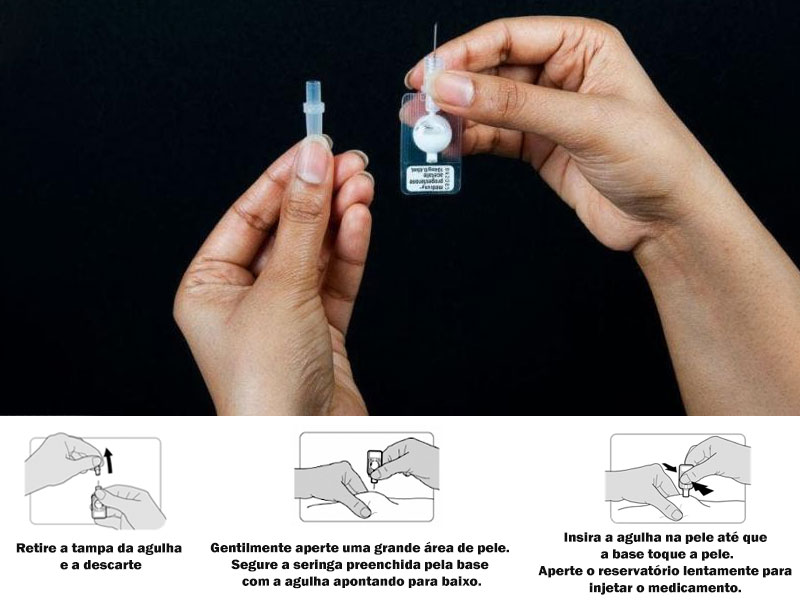 Aplicação da injeção anticoncepcional por via subcutânea.