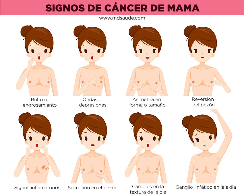 Principales signos de tumor en la mama