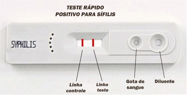 Teste rápido para sífilis