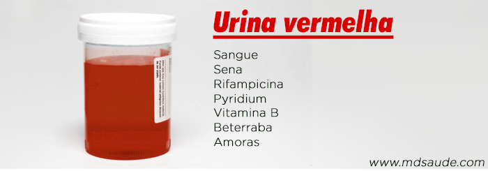 Causas de xixi vermelho