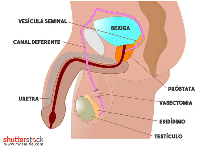 Vasectomia - Anatomia geniturinária